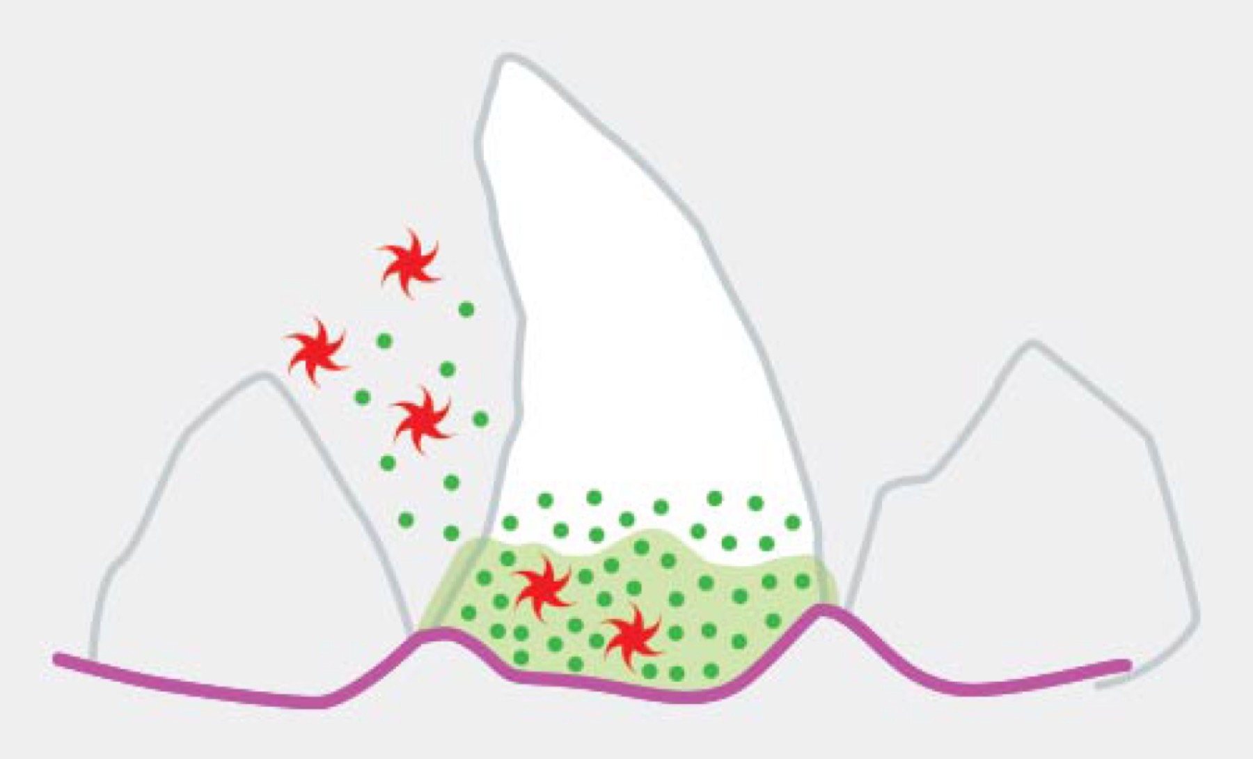 Illustration: plaque bacteria accumulating at the gumline